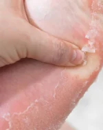 Mascarilla exfoliante para pies coreana